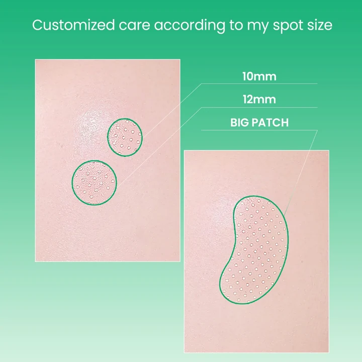 No Problem Spot Patch: Pick a size that covers the spot